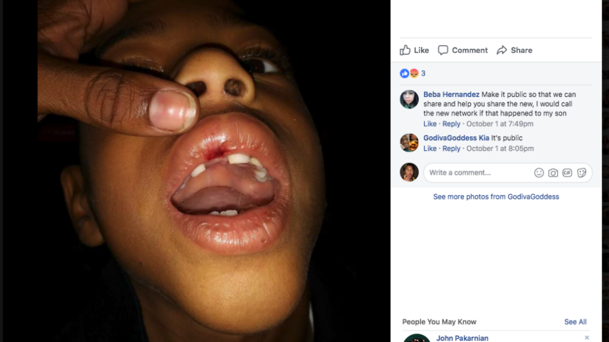 A teacher allegedly pushed Marlon K’Harii Williams, 6, so hard a tooth was knocked while another had to be removed.