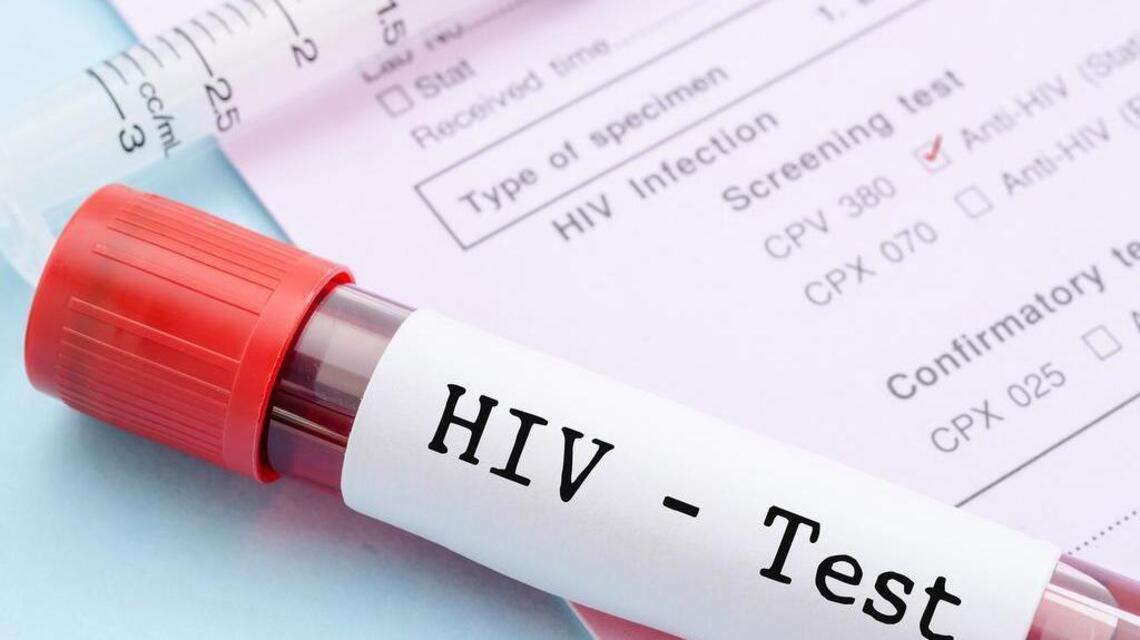 Free HIV testing available Thursday in Modesto. Here’s where to get it