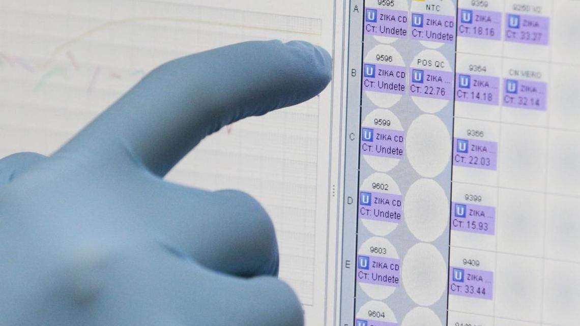 A medical researcher uses a monitor that shows the results of blood tests for various diseases, including Zika, at the Gorgas Memorial laboratory in Panama City on Feb. 4, 2016. The US Food and Drug Administration has authorized Quest Diagnostics to offer the first commercial test for the Zika virus in the United States.