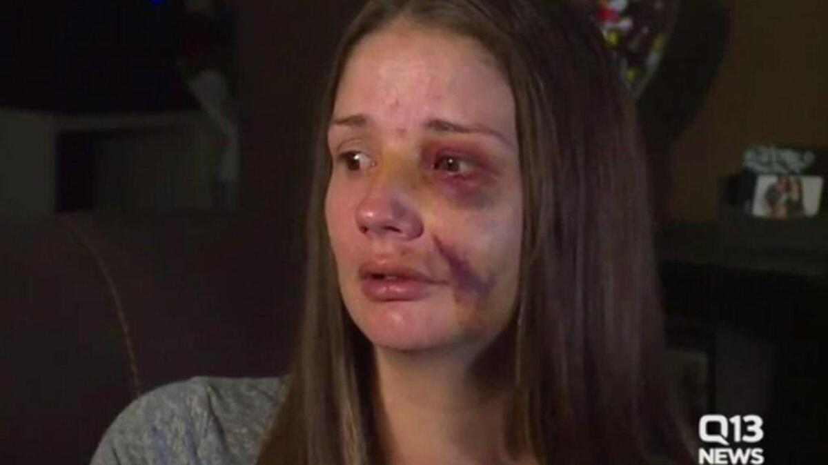 A Federal Way, Wash. woman tried warning others of a man fondling himself outside a grocery store, and then he attacked her, she says.