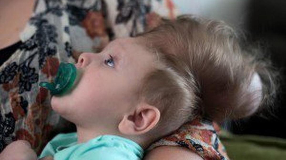 Bentley Yoder before surgery.