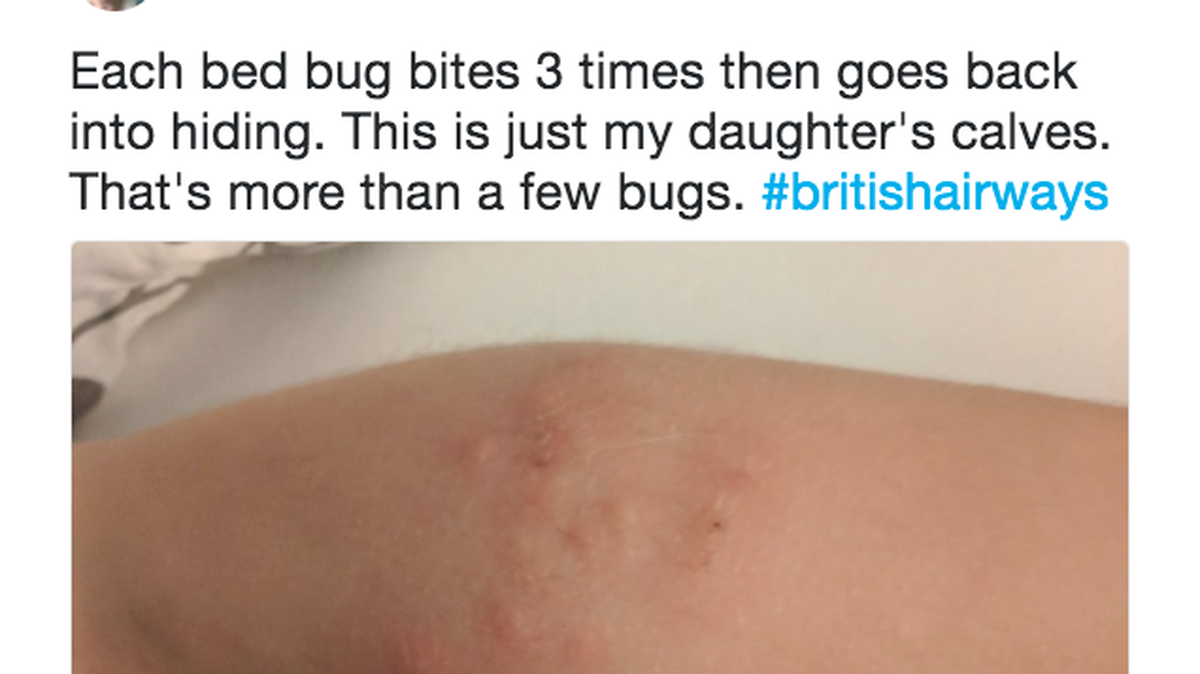 A Canadian woman says she, her fiance and her daughter endured a nine-hour British Airways flight on Oct. 10 sitting in seats where bedbugs bit them.