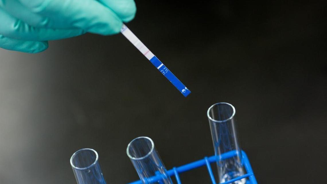 A lab technician demonstrates the use of fentanyl testing strips at the Rhode Island Department of Health Laboratory in Providence, Rhode Island, January 10, 2018.