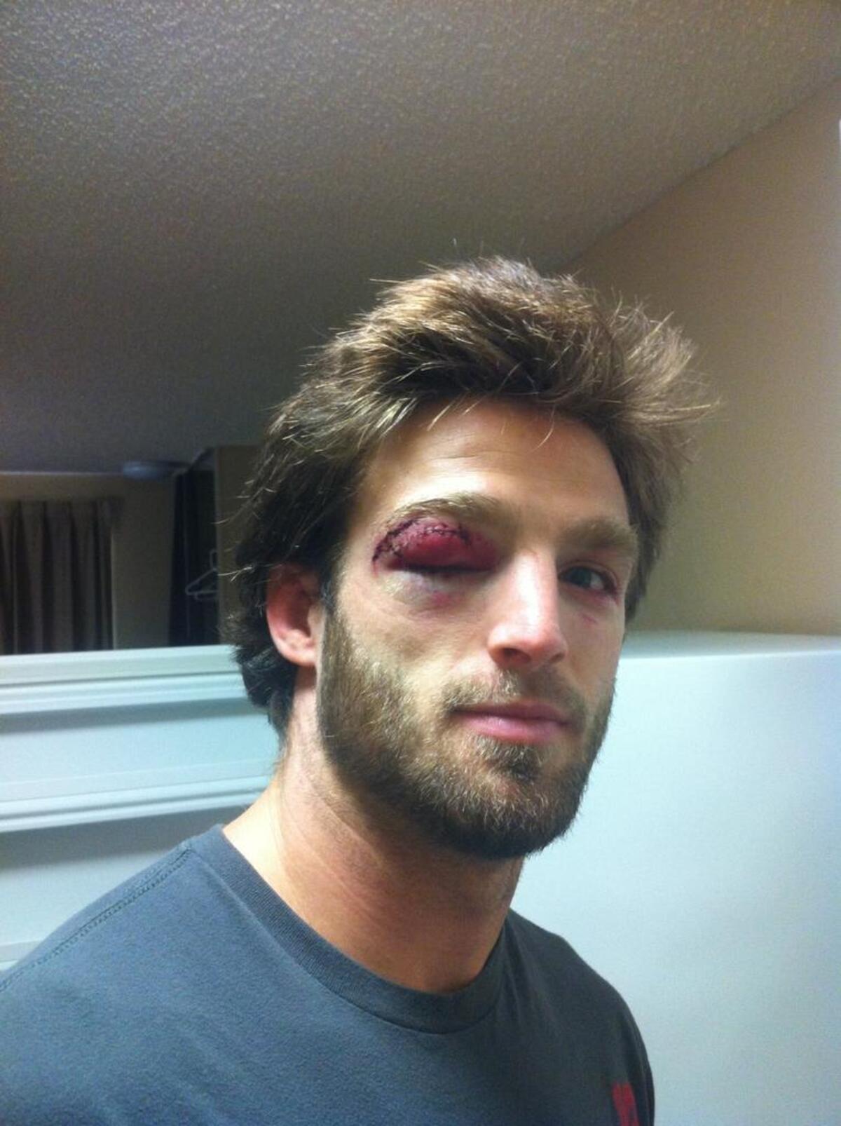 Jordan Rinaldi after a loss in a pro bout in 2013.