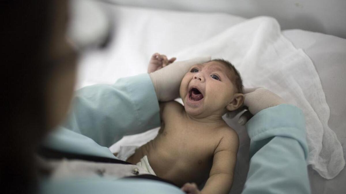In this Feb. 12, 2016 photo, Lara, who is just under 3- months-old and was born with a shrunken head, a rare condition known as microcephaly and caused by a Zika infection in mothers. (AP Photo/Felipe Dana)