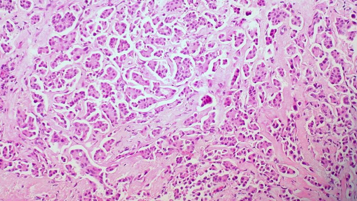 Scientists have found a clue to stopping cancer from spreading in the body.