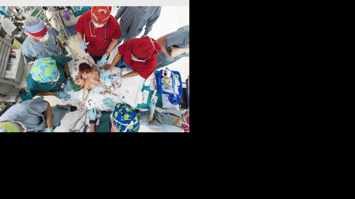 Surgeons and clinicians at Texas Children’s Hospital prepare to separate conjoined twins Knatalye Hope and Adeline Faith Mata. Born in April 2014 at Texas Children’s Pavilion for Women, the girls were successfully separated on Feb. 17, 2015, and are recovering.
