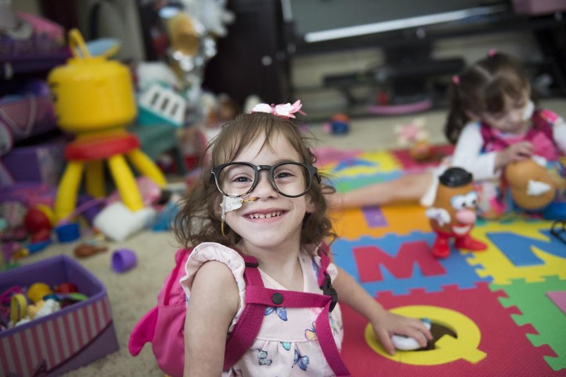 Erika Sandoval wears toy glasses while playing with Mr. Potato Head at home in Antelope, Calif. Wednesday, June 14, 2017, along with her formerly conjoined twin sister, Eva, right.