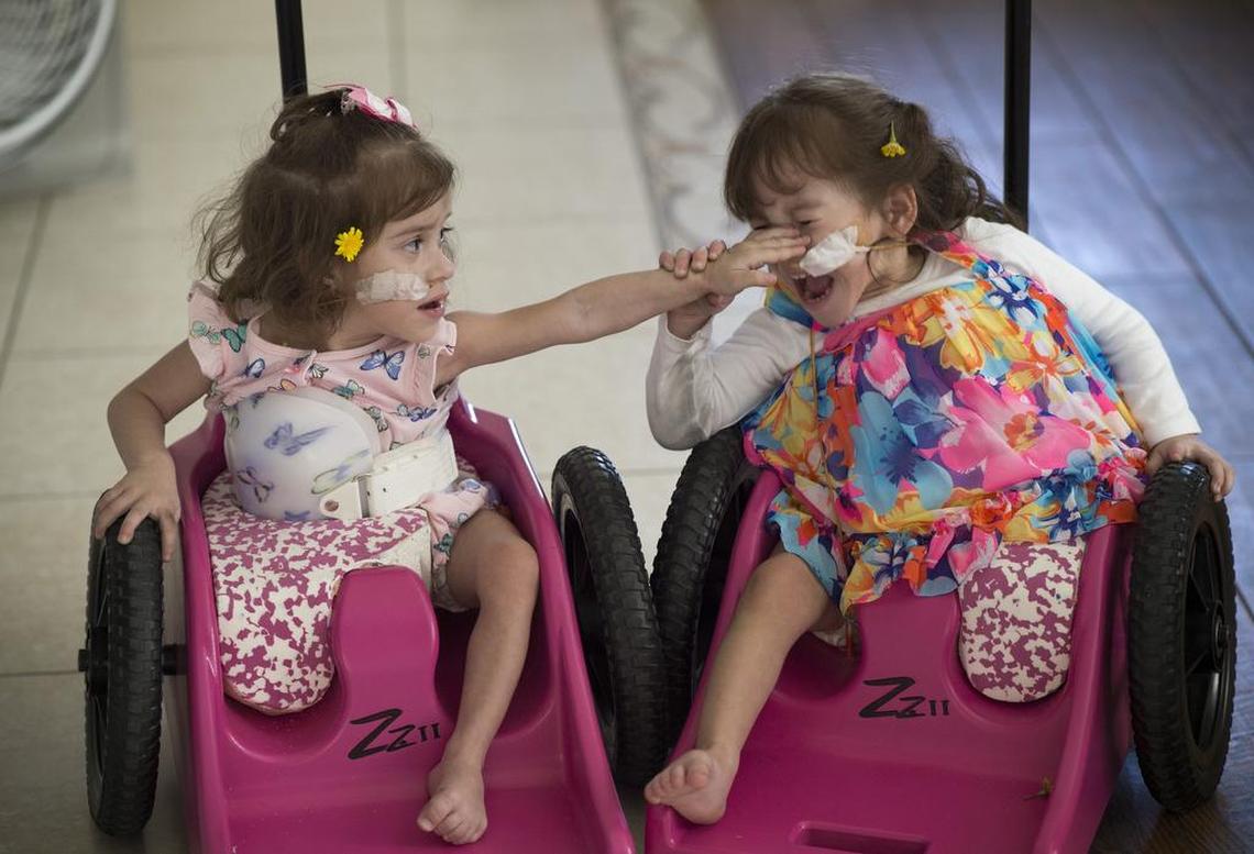Erika Sandoval, left, lashes out at her twin sister, Eva Sandoval as their wheelchairs collide while cruising around the house, Wednesday, June 14, 2017 in Antelope, Calif. After their separation surgery in December, Erika has discovered her independence which has led to new sibling power struggles.