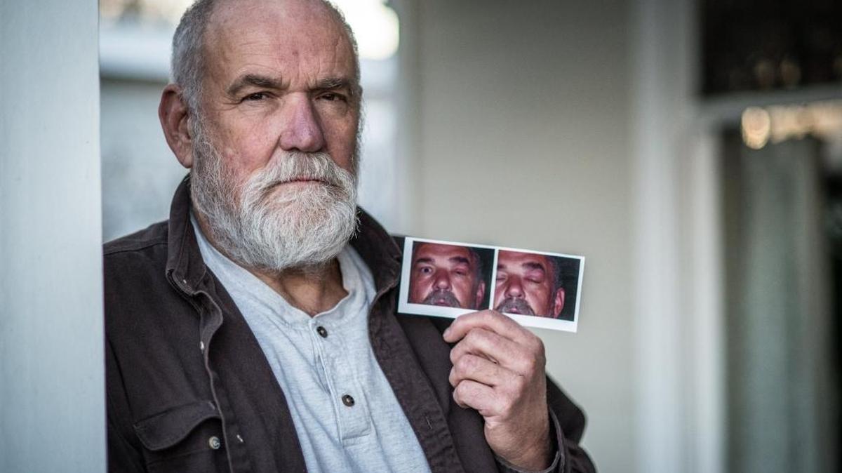John Swain, who worked as an operator at the Hanford Site nuclear complex, was in an accident on August 17, 2003, that left him with toxic encephalopathy, reactive airways disease syndrome and neuropathy of the lower extremities. His left eye swells up from time to time when he is exposed to certain common chemicals. He is photographed in his home in Richland, Wash., on Dec. 30, 2015.
