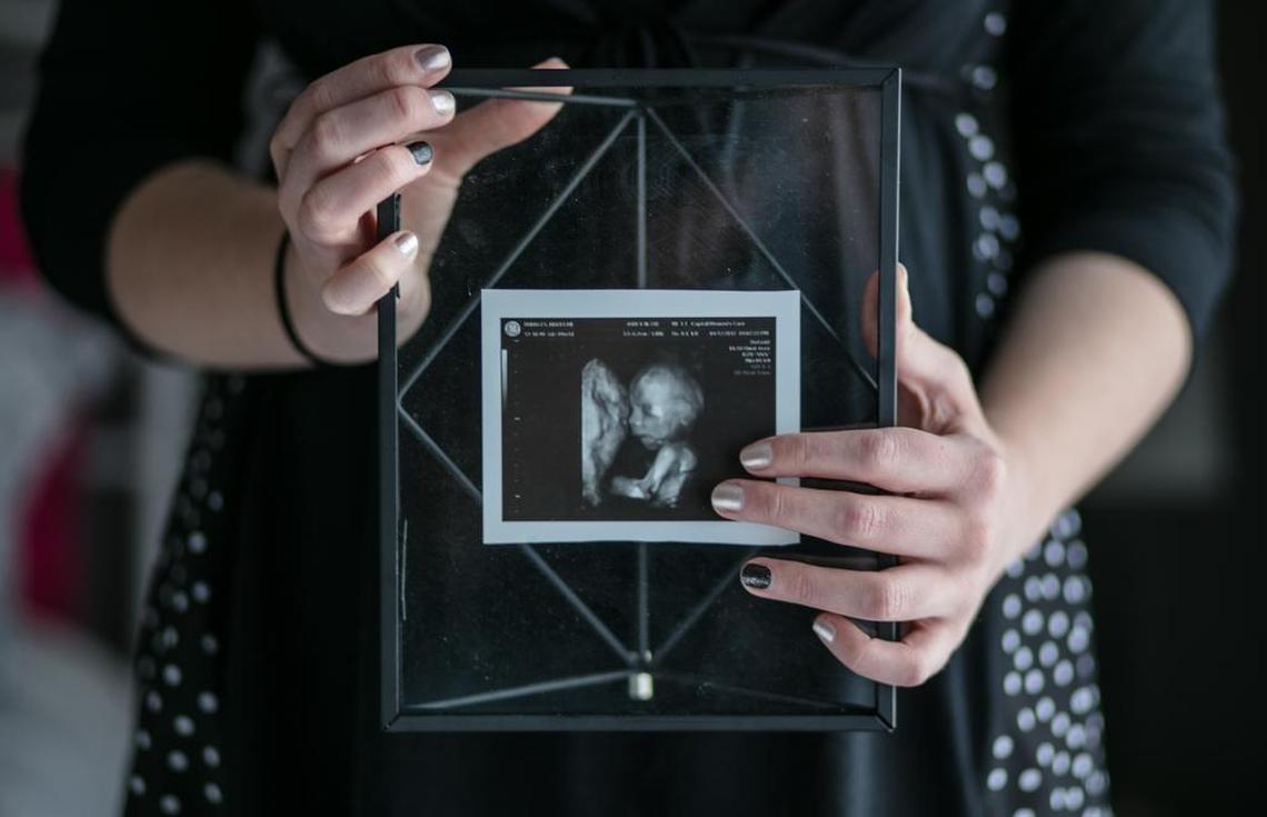 Maddi Runkles holds a photo of her ultrasound at her home in Boonsboro, Md., May 8, 2017. Officials at her private Christian high school barred Runkles from walking at her graduation because she is pregnant. Her family is seeking help from Students for Life, an anti-abortion group that argues she should be lauded, not punished, for her decision to keep her baby.
