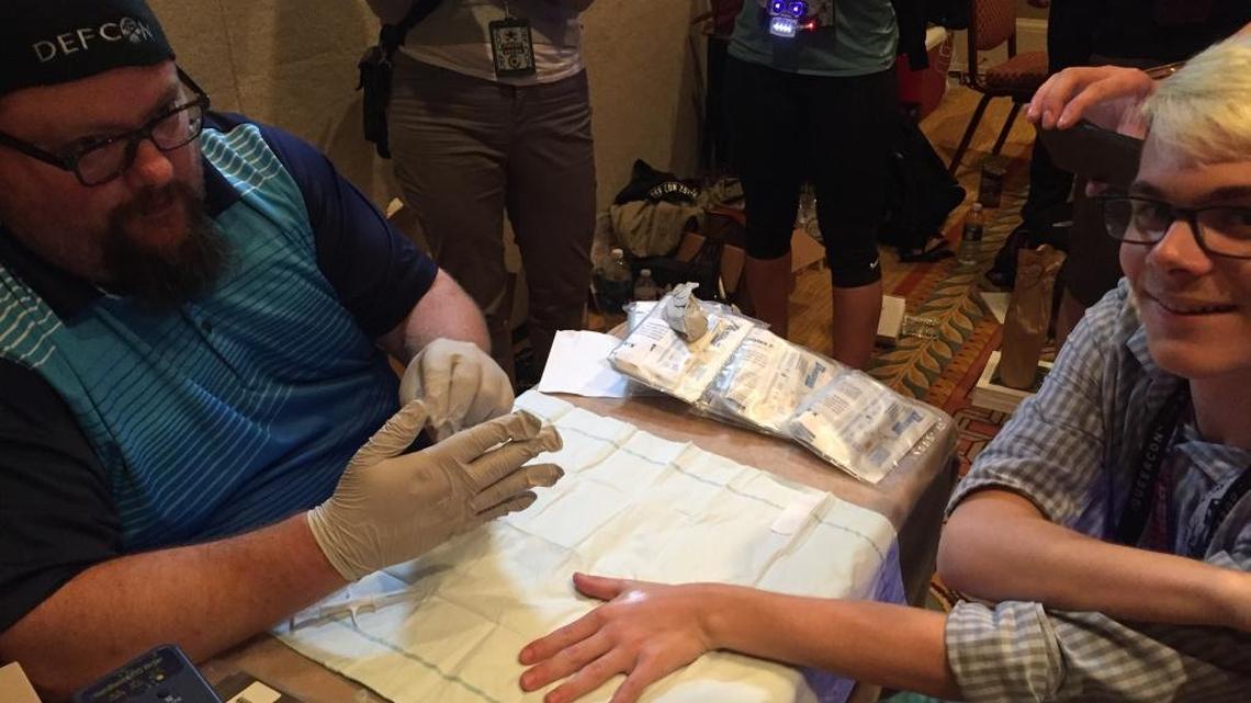 Dawn of the bionic age: Body hackers let chips get under their skin