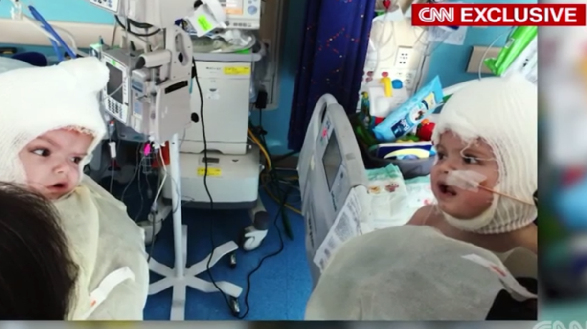 CNN’s coverage of the twins included an image of the two looking at each other for the first time.
