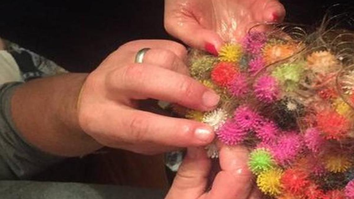Parents are trying conditioner and coconut oil to try to remove Bunchems stuck in their children’s hair.