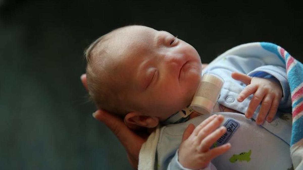 Brandi McGlathery tended to her son Eli at the NICU at USA Children’s and Women’s Hospital in Mobile, Ala., in March 2015. Eli was born without a nose on March 4, 2015.