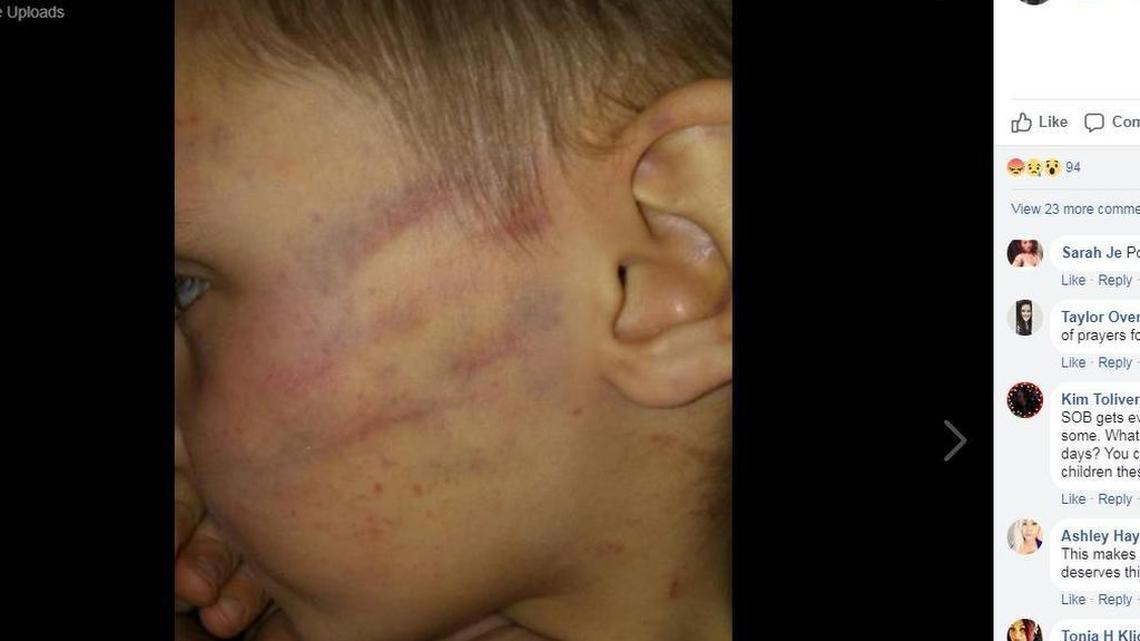 Bridgette Payne posted photos of her 5-year-old son who was allegedly beaten by her boyfriend.