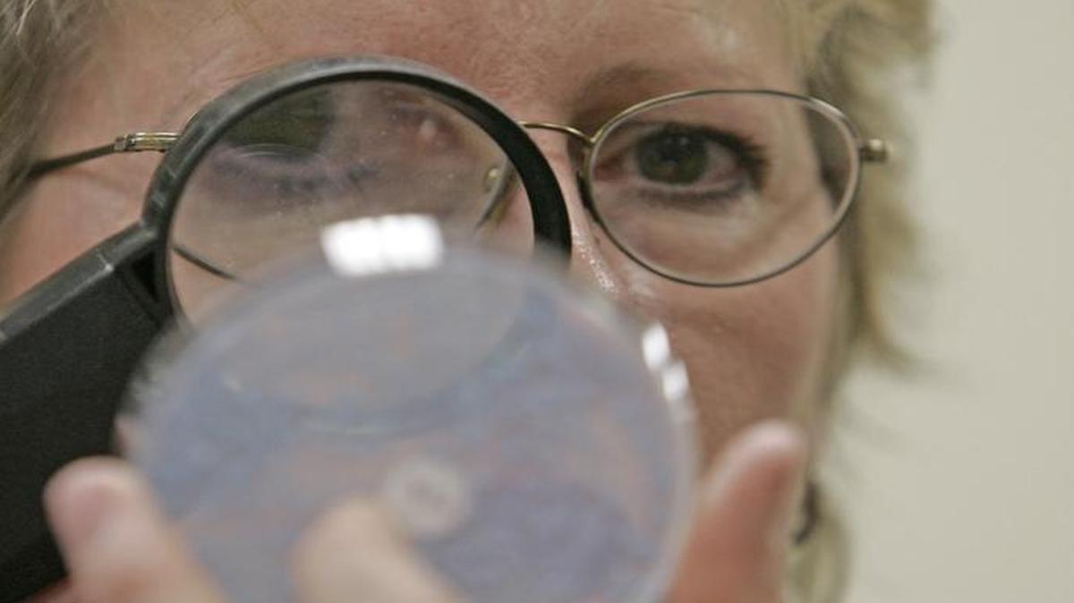 Nearly three dozen people in the United States have been diagnosed with a deadly and highly drug-resistant fungal infection since federal health officials first warned U.S. clinicians to be on the lookout last June.