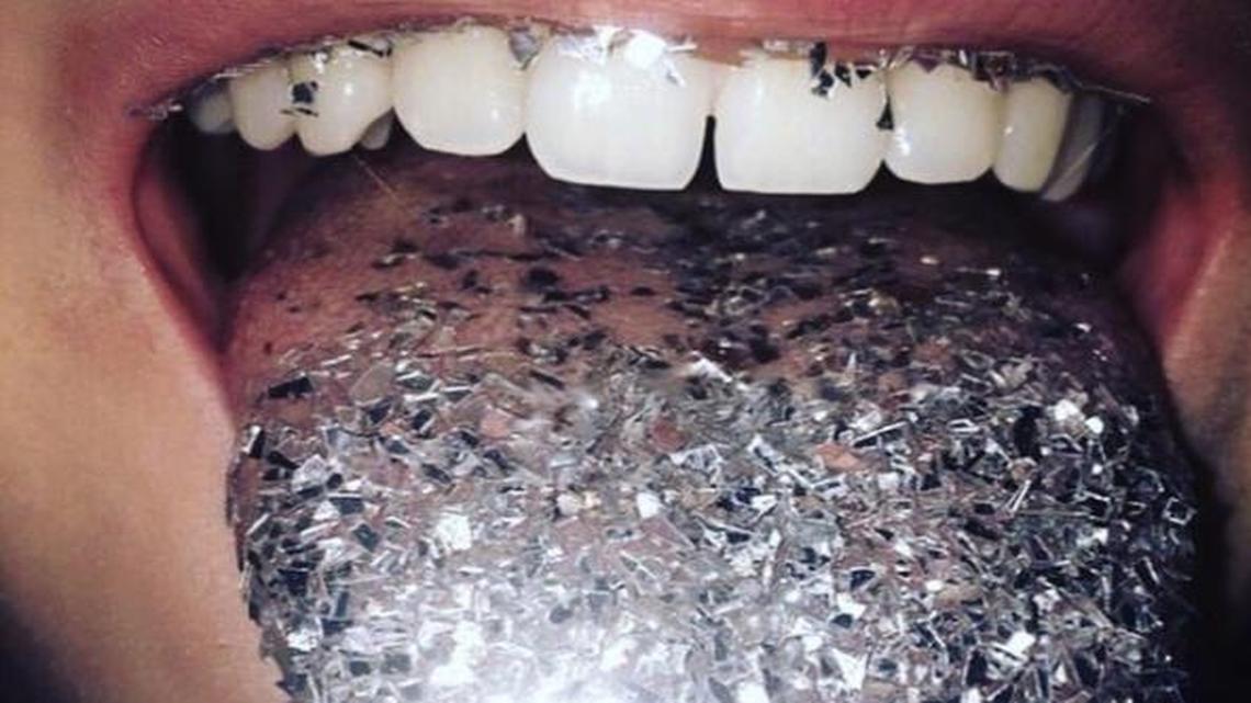 Glitter teeth are nearly unavoidable.