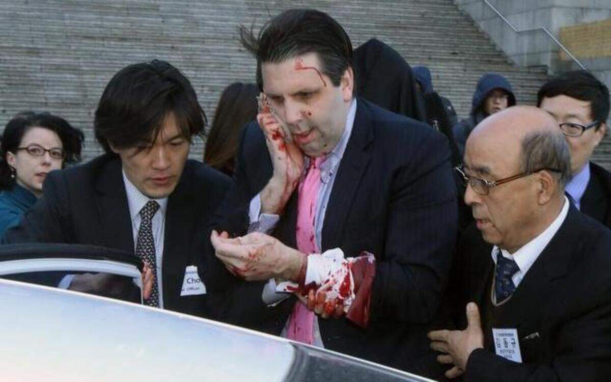 
Injured U.S. Ambassador to South Korea Mark Lippert, center, gets into a car to leave for a hospital in Seoul, South Korea, Thursday, March 5, 2015. Lippert was attacked by a man wielding a razor and screaming that the rival Koreas should be unified, South Korean police and media said Thursday. He was taken to a hospital for treatment.
