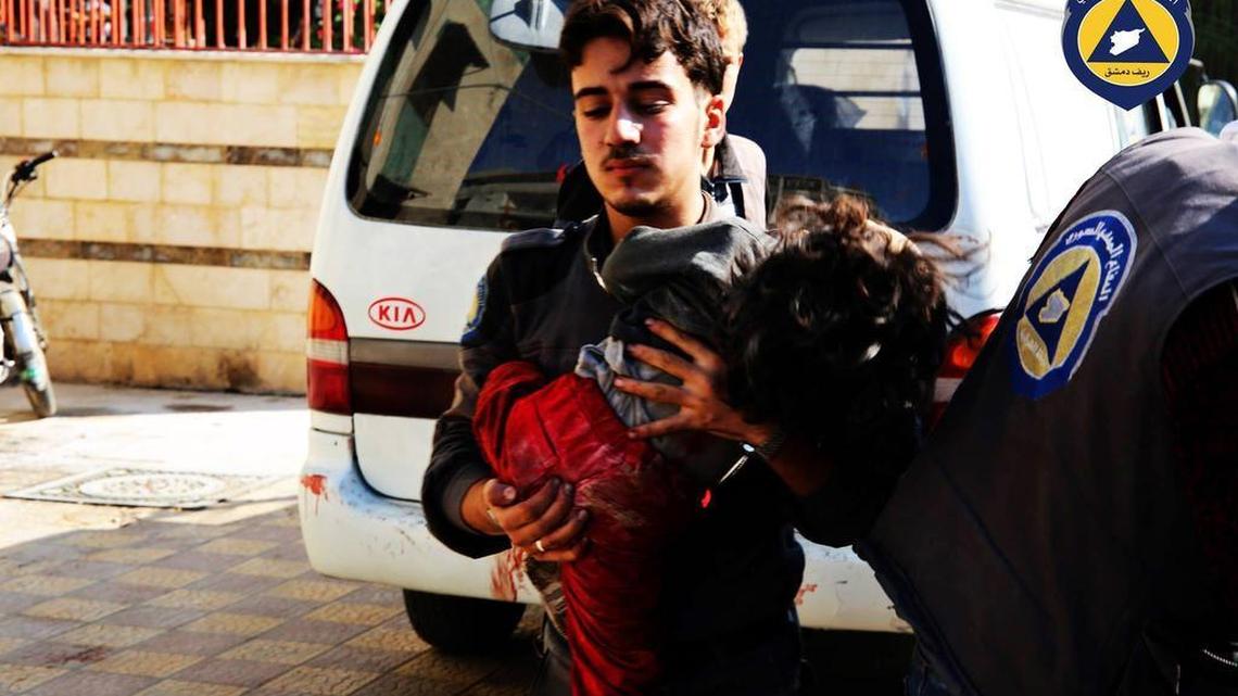 This photo provided by the Syrian anti-government activist group Syrian Civil Defence, as also known as the White Helmets, which has been authenticated based on its contents and other AP reporting, a paramedic holds a child from a market after what witnesses said it was hit by Syrian government forces in Douma, Syria, Friday, Oct. 30, 2015. The Syrian Observatory for Human Rights and the Local Coordination Committees group said government forces fired more than 11 missiles at a market in Douma, killing at least 40.