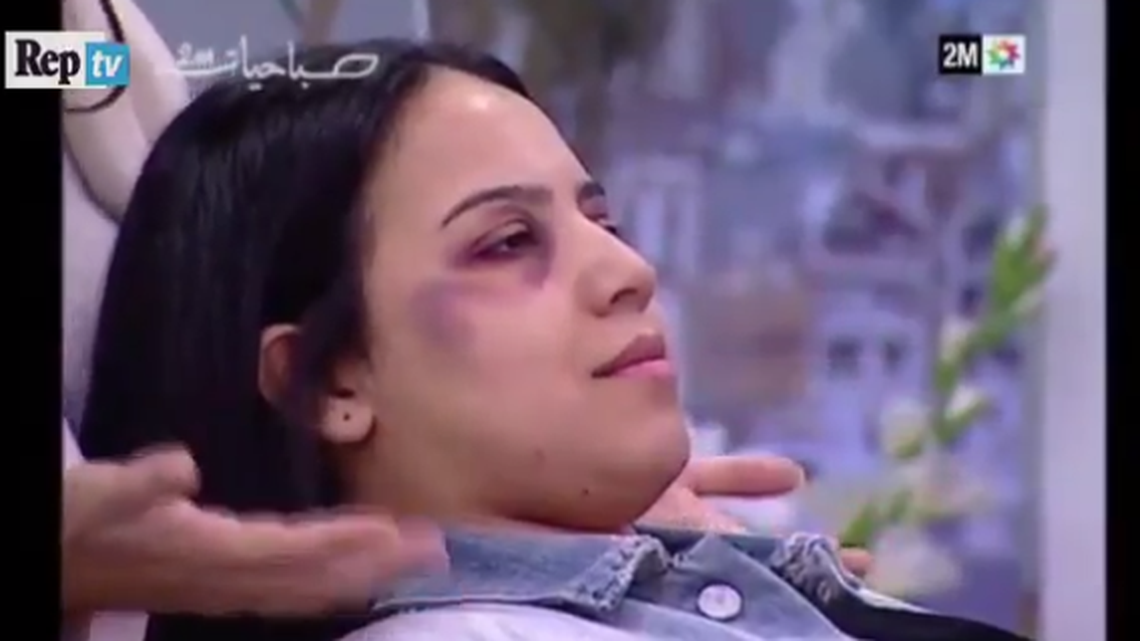 The host of this segment on Moroccan state TV told viewers, “We hope that these beauty tips help you carry on with your normal life.”