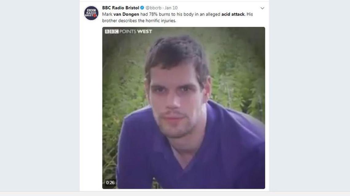 Berlinah Wallace faces a murder charge after allegedly splashing acid on her ex-lover, Mark van Dongen. He died in a medically-assisted suicide.