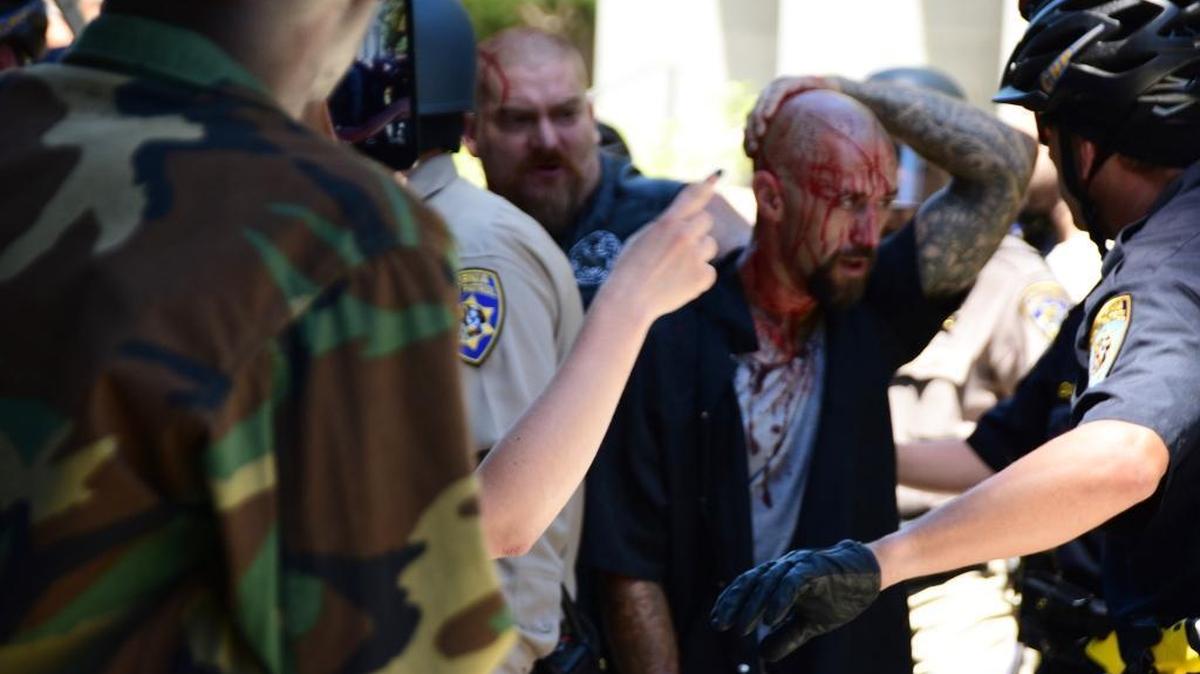 Police escort a wounded man from the Sacramento protests Sunday after members of right-wing extremist groups holding a rally outside the California Capitol clashed with counter-protesters, authorities said. The Traditionalist Workers Party had scheduled and received a permit to protest at noon Sunday.