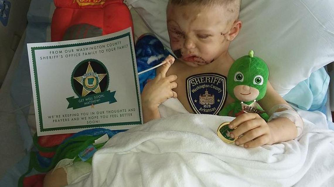 Two pit bulls in West Fork, Arkansas, attacked 4-year-old Matthew Guess as he walked outside Thursday, leaving the boy with serious injuries and in need of facial reconstruction surgery. Police have named Guess an honorary deputy sheriff as he recovers in the hospital.